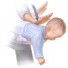 Heimlich