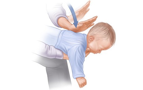 Ce e de făcut când bebelușul se îneacă cu mâncare?